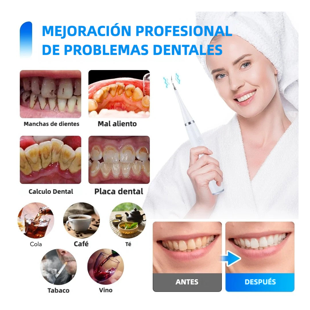 Limpiador Ultrasónico de Placa para Dientes, Removedor de Manchas Dentales con Luz LED, Kit para Blanqueo de Dientes para Niños y Adultos, 3 Modos - CS001