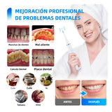 Limpiador Ultrasónico de Placa para Dientes, Removedor de Manchas Dentales con Luz LED, Kit para Blanqueo de Dientes para Niños y Adultos, 3 Modos - CS001