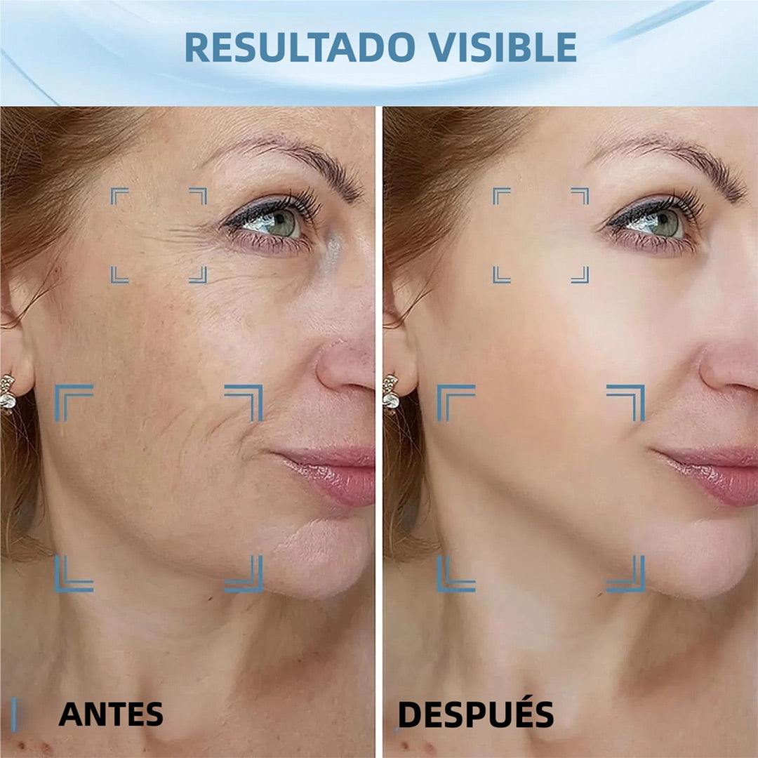 Masajeador Facial y de Cuello de 7 Colores con Tecnología de Vibración, Cepillo Facial Recargable para Cuidado de la Piel (Blanco) - MJ001
