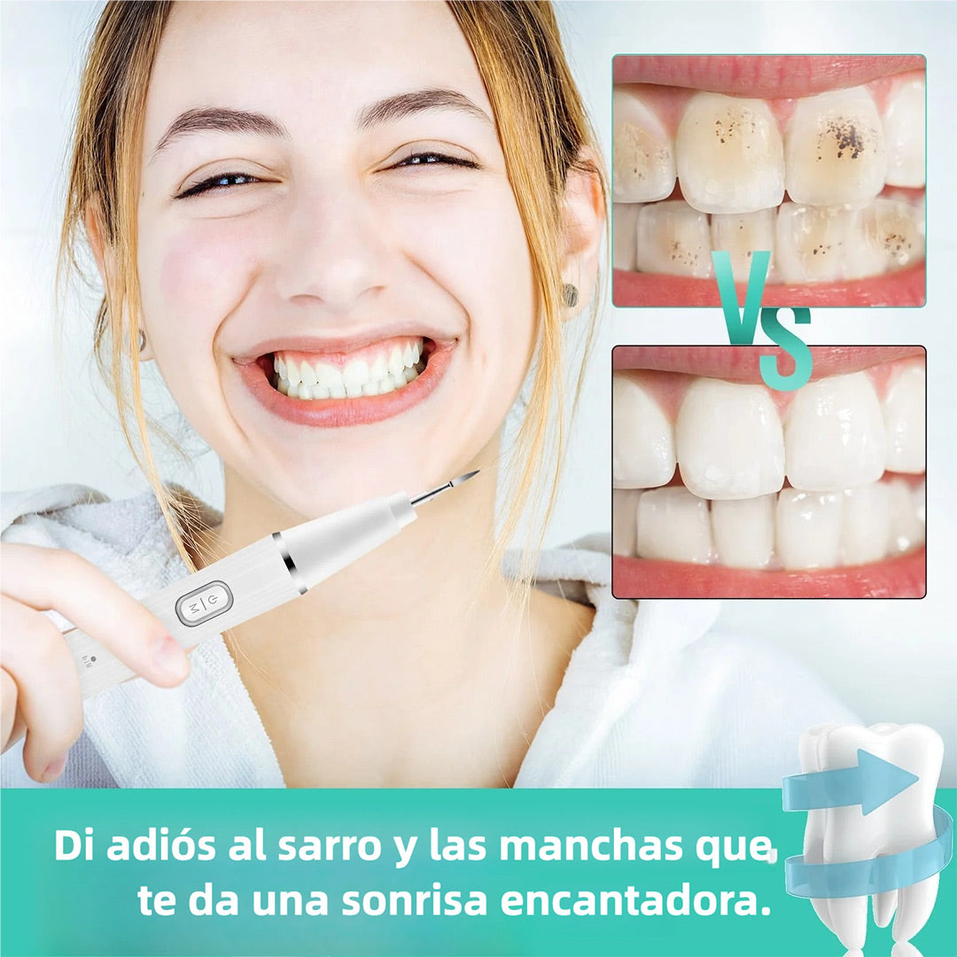 Limpiador Ultrasónico de Placa para Dientes, Removedor de Manchas Dentales con Luz LED, Kit para Blanqueo de Dientes para Niños y Adultos, 3 Modos - CS001