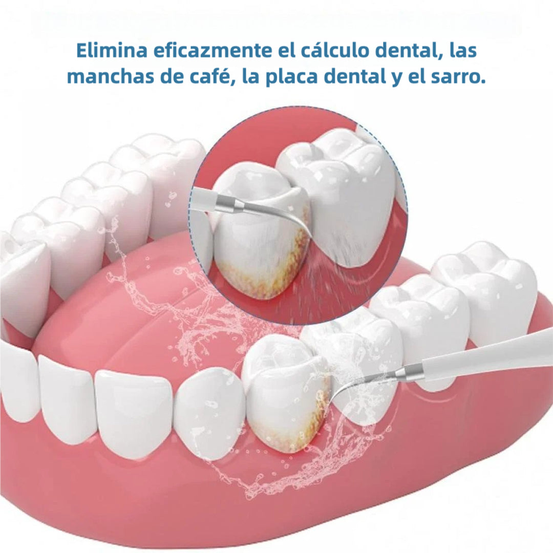 Limpiador Ultrasónico de Placa para Dientes, Removedor de Manchas Dentales con Luz LED, Kit para Blanqueo de Dientes para Niños y Adultos, 3 Modos - CS001